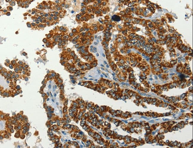 SERPINA9 Antibody