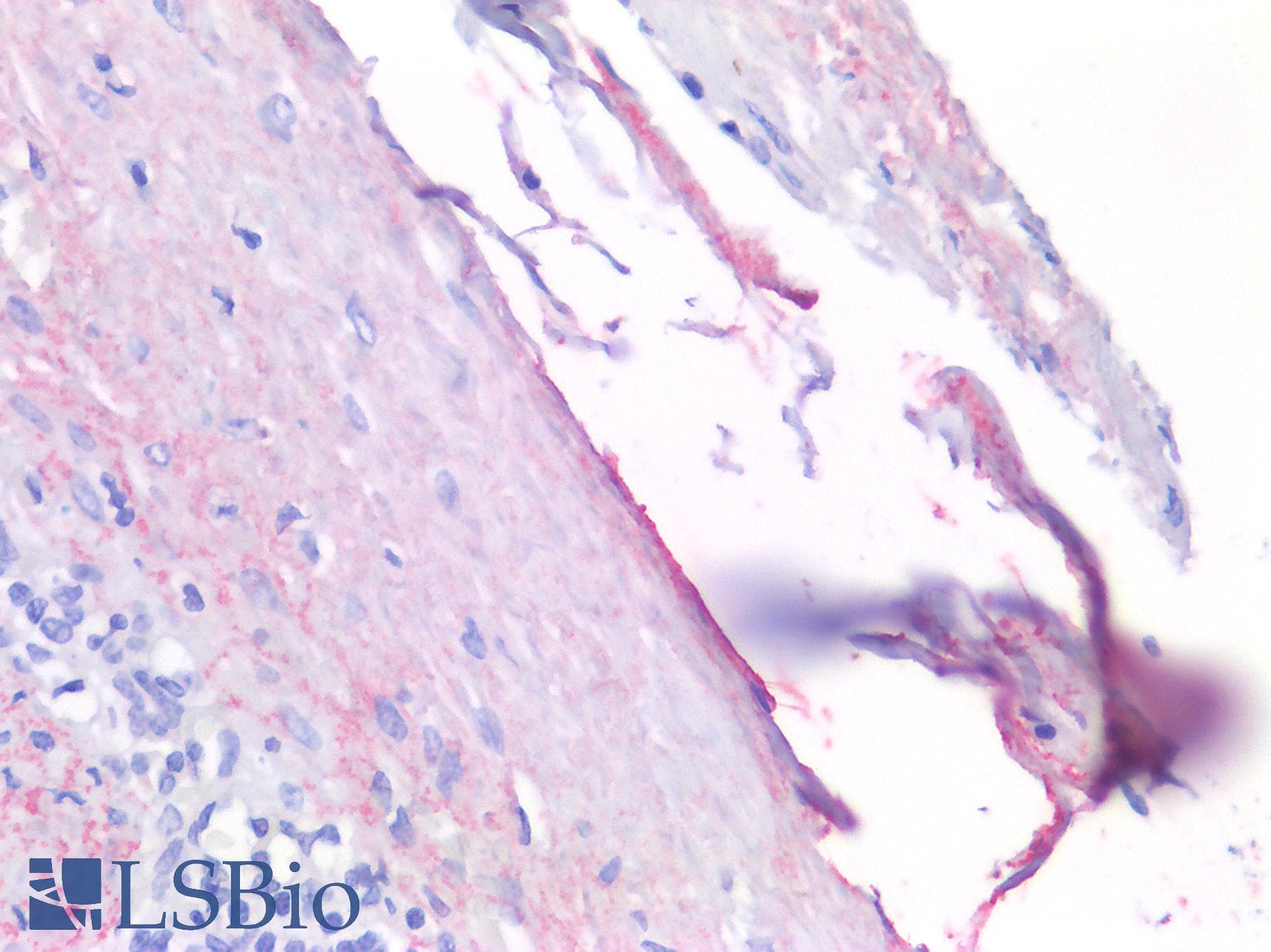 IHC-plus™ MSLN / Mesothelin Antibody