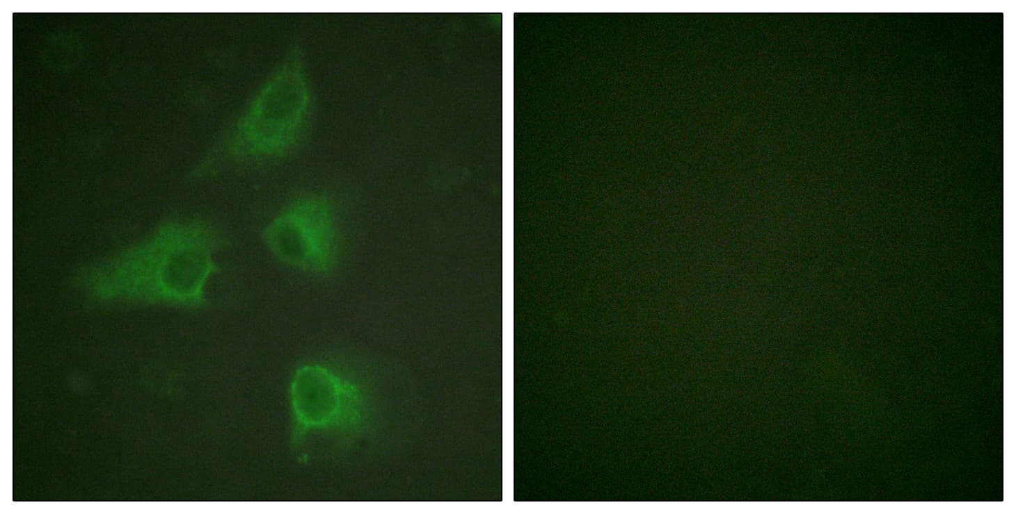 IHC-plus™ DPYSL2 / CRMP2 Antibody (aa480-529)