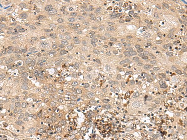 GFI1 Antibody
