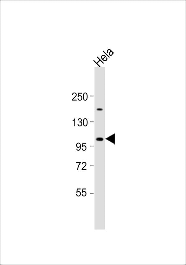 GTF3 / GTF2IRD1 Antibody