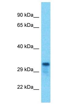 Polyclonal Rabbit anti-Human TMEM221 Antibody (aa177-226, WB)