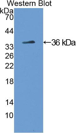 TH / Tyrosine Hydroxylase Antibody (aa34-301)