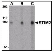IHC-plus™ STIM2 Antibody