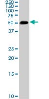 SMAD1 Antibody (clone 2E9)