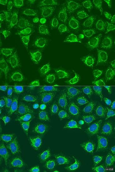 Polyclonal Rabbit anti-Human ALG2 Antibody (IF)