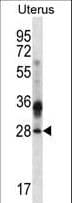 CIB4 Antibody (aa26-54)