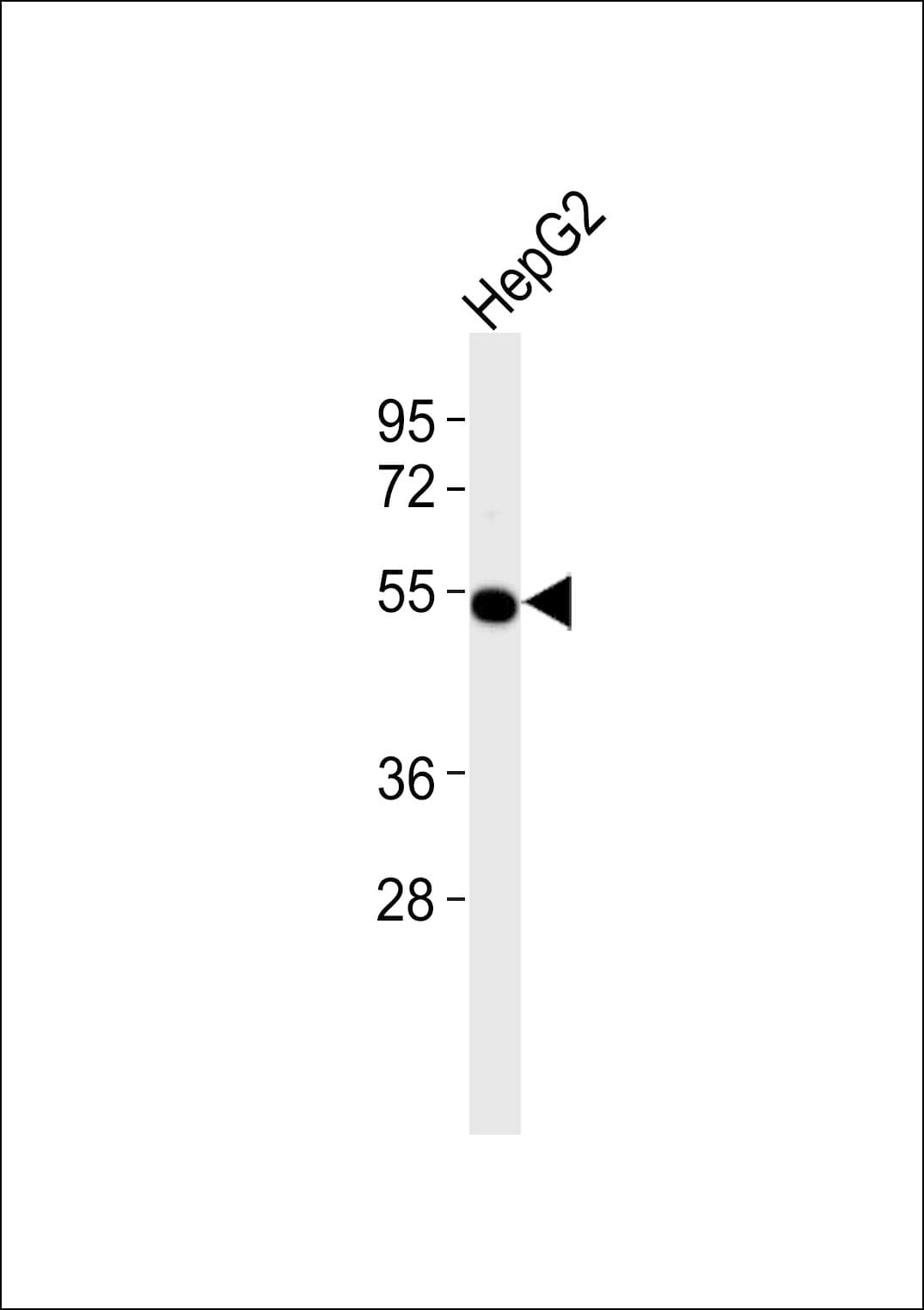 ALDH2 Antibody