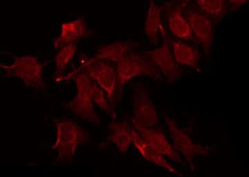 PTPN6 / SHP1 Antibody