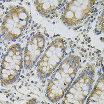 MYD88 Antibody