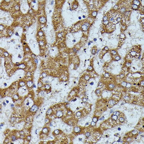 APOC3 / Apolipoprotein C III Antibody