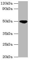Polyclonal Rabbit anti-Human IDH2 Antibody (aa193-452, IHC, WB)