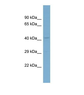 CACNB2 Antibody (aa259-308)