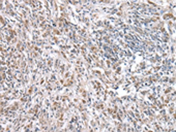 RNF115 / BCA2 Antibody
