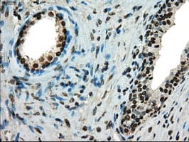 Monoclonal Mouse anti-Human TYRO3 Antibody (clone OTI2G2, IHC, WB)