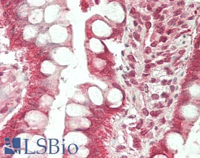 IHC-plus™ Polyclonal Rabbit anti-Human TJP2 / ZO2 / ZO-2 Antibody (IHC, WB)