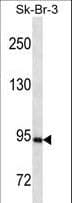 PR / Progesterone Receptor Antibody (aa349-377)