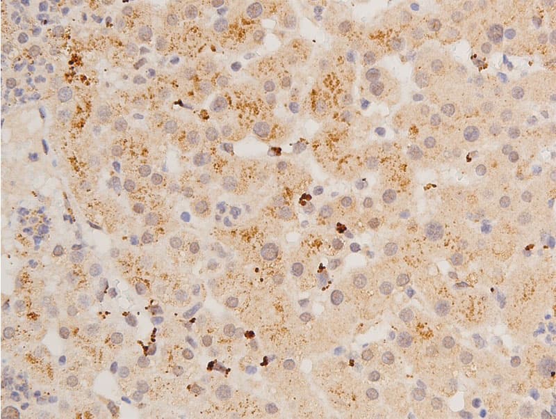 TP53 / p53 Antibody (phospho-Ser392)