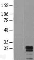 LDOC1L Protein (Over-Expression Lysate Myc-DDK (Flag))