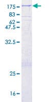 Human TPO / Thyroid Peroxidase Protein (Recombinant GST)