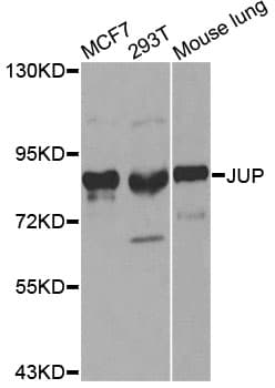 Polyclonal Rabbit anti-Human JUP/CTNNG/Junction Plakoglobin Antibody (IHC, IF, WB)