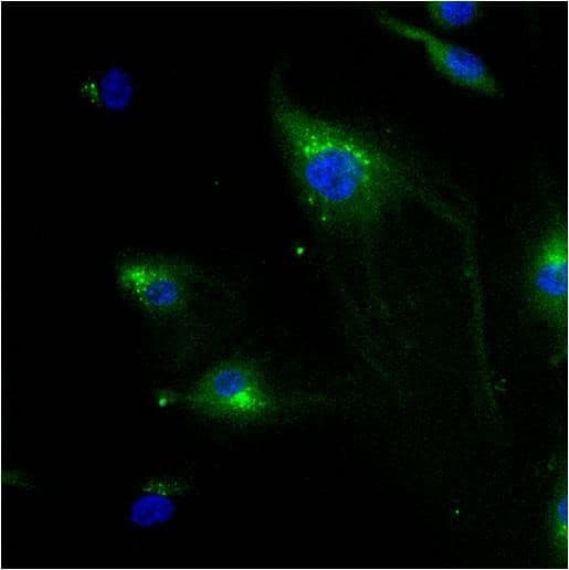 IGF2R / CD222 Antibody (clone 2G11)