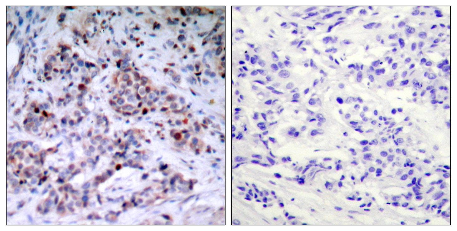 Polyclonal Rabbit anti-Human RELA / NFKB p65 Antibody (phospho-Thr435, IHC, WB)