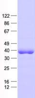 Human ANKRA2 / ANKRA Protein (Recombinant His, N-Terminal)