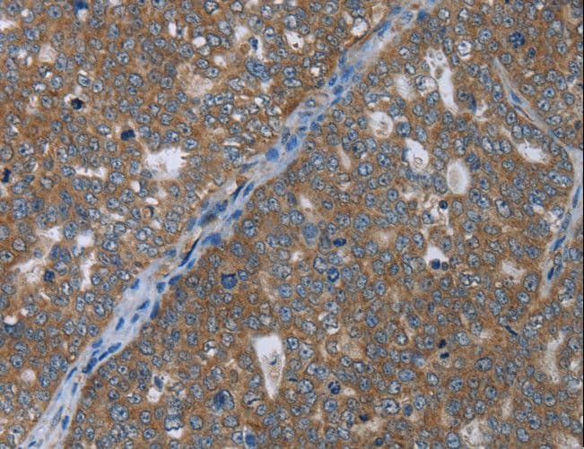 GABRB1 Antibody