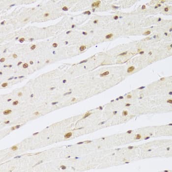 Polyclonal Rabbit anti-Human MAPK3 / ERK1 Antibody (IHC, IF, WB)