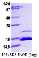 Human FKBP1B / FKBP12.6 Protein (Recombinant His)