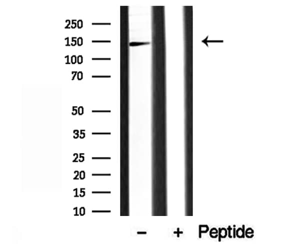 Polyclonal Rabbit anti-Human AP3B1 Antibody (IHC, WB)