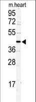Polyclonal Rabbit anti-Human DCC1 / DSCC1 Antibody (aa61-87, IHC, WB)