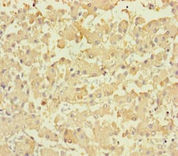 LPPR2 Antibody