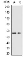 TPH2 Antibody