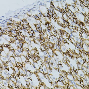 CLDN3 / Claudin 3 Antibody