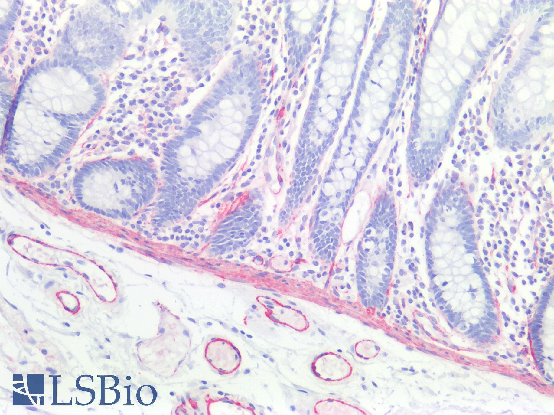 PathPlus™ CALD1 / Caldesmon Antibody (aa1-240)