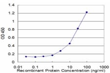 Monoclonal Mouse anti-Human CPT1A Antibody (clone 1D3, WB)