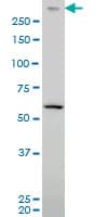 IHC-plus™ PRKDC / DNA-PKcs Antibody (clone 2A8)