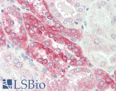 Polyclonal Rabbit anti-Human PDE1A Antibody (C-Terminus, IHC, WB)