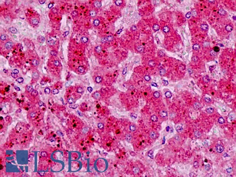 IHC-plus™ HRH1 / Histamine H1 Receptor Antibody (aa141-190)