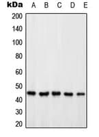 Polyclonal Rabbit anti-Human PSMD6 Antibody (Internal, IHC, WB)