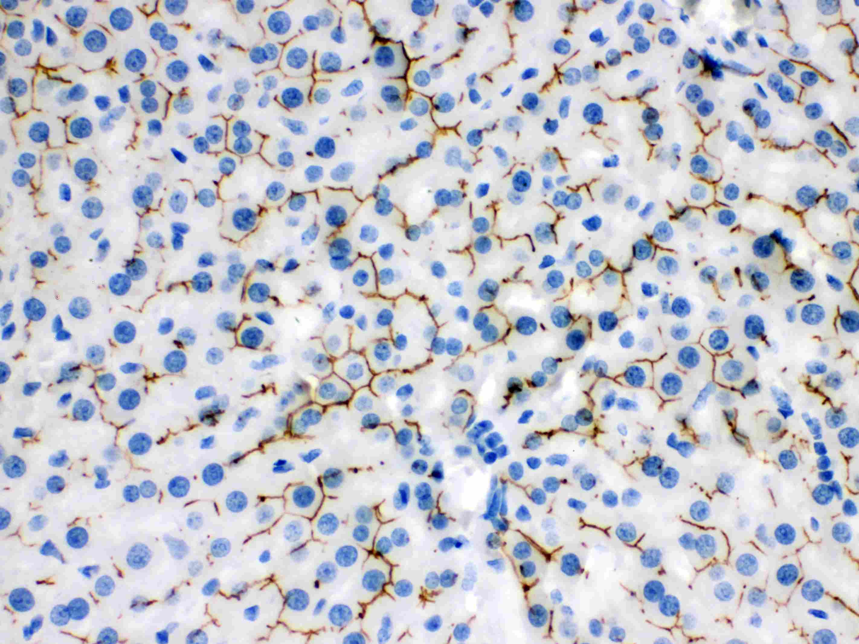 ABCB11 / BSEP Antibody