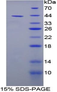 Rat NPPC Protein (Recombinant His-GST)