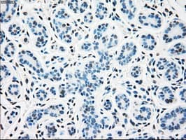 SSB / La Antibody (clone OTI3H9)