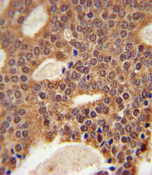 Polyclonal Rabbit anti-Human DCLRE1B Antibody (aa208-236, IHC, WB)