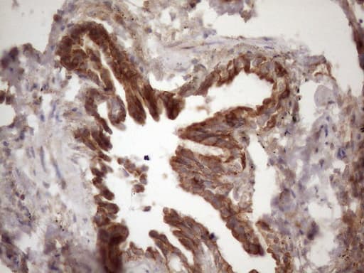 IKBKE / IKKI / IKKE Antibody (aa474-716, clone OTI1E4)