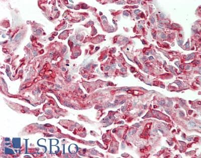 KNG1 + KNG2 Antibody (aa2-110)