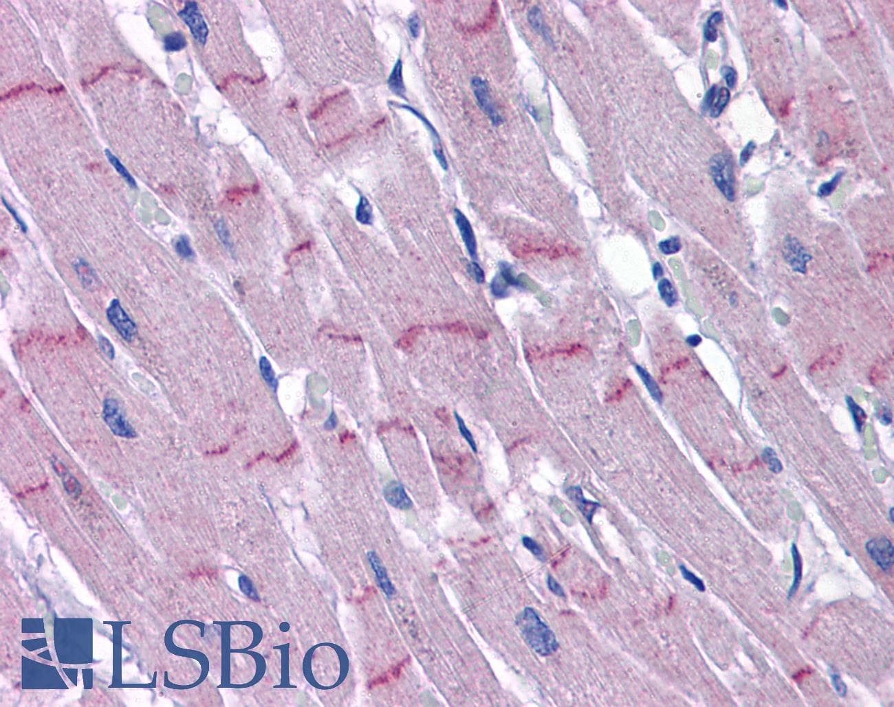 IHC-plus™ PAPPA2 / Pappalysin 2 Antibody