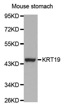 IHC-plus™ KRT19 / CK19 / Cytokeratin 19 Antibody